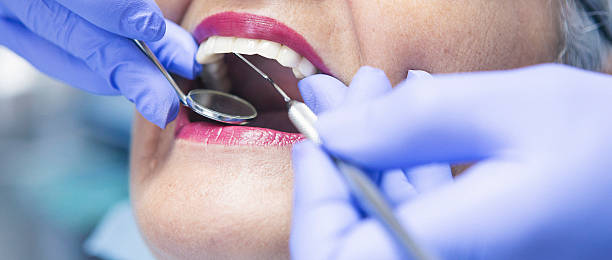 Best Emergency Dentist for Special Needs Patients in Mountain View Acres, CA